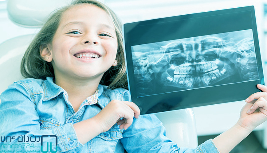 تجهیزات دندانپزشکی رادیوگرافی دندانپزشکی دندان724 dandan724