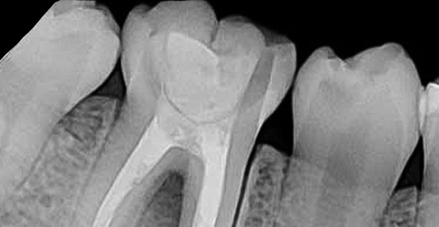 تجهیزات دندانپزشکی دست دوم | رادیوگرافی تک دندان دندان724