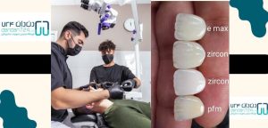 خدمات دندانپزشکی - روکش دندان