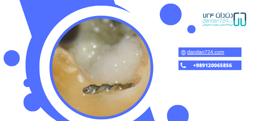 عفونت تیغه - فایل دندانپزشکی