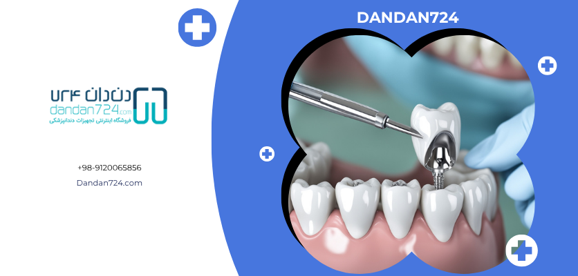 آمالگام - آمالگام دندانی