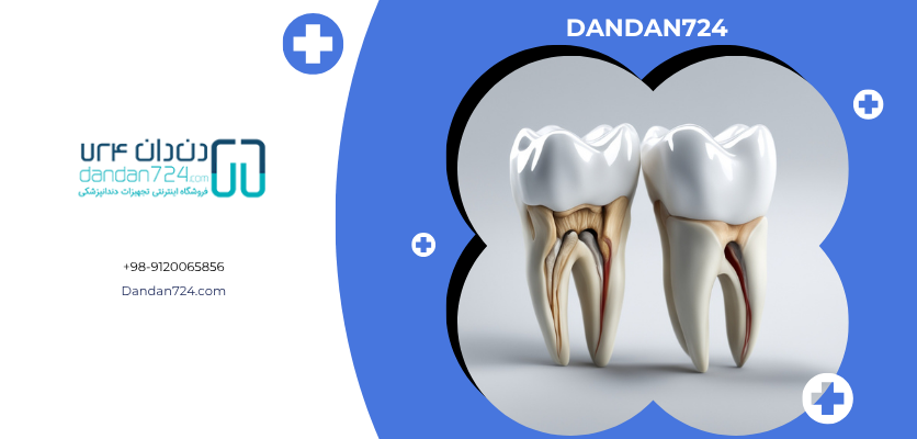مقایسه آمالگام با کامپوزیت - آمالگام دندانی