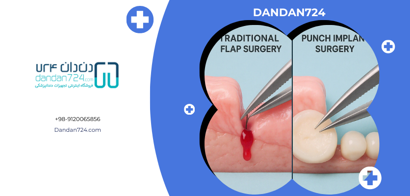 مقایسه ایمپلنت سنتی و پانچی - ایمپلنت پانچ