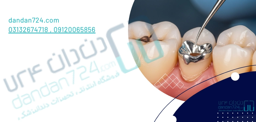 پانسمان-پانسمان دندان