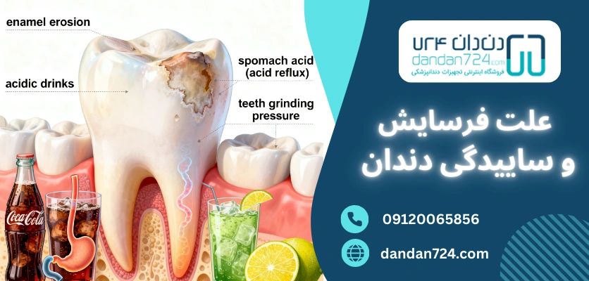 علت فرسایش و ساییدگی - فرسایش دندان