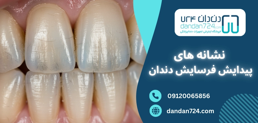 نشانه های پیدایش فرسایش فرسایش دندان