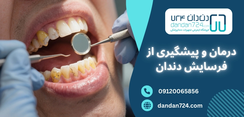 درمان و پیشگیری از فرسایش - فرسایش دندان