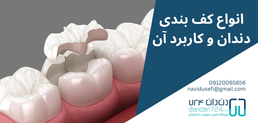 انواع و کاربرد ها - کف بندی دندان