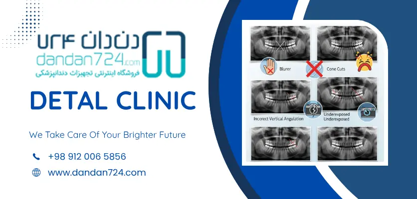 شاخص رادیوگرافی دندان - خطا های رادیوگرافی