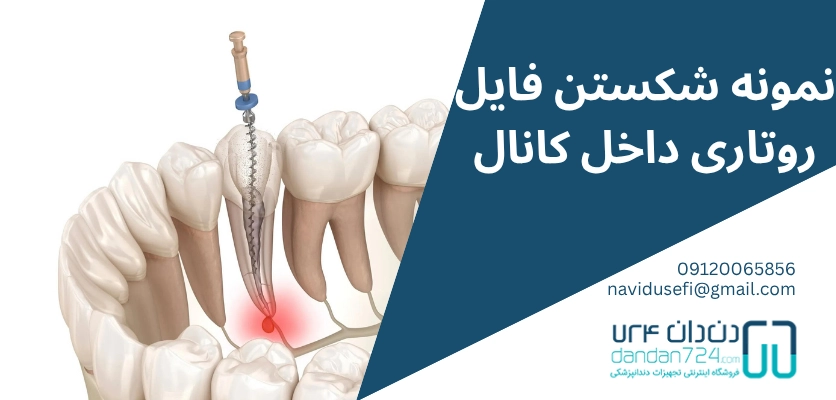 فایل روتاری شکسته - شکستن فایل روتاری