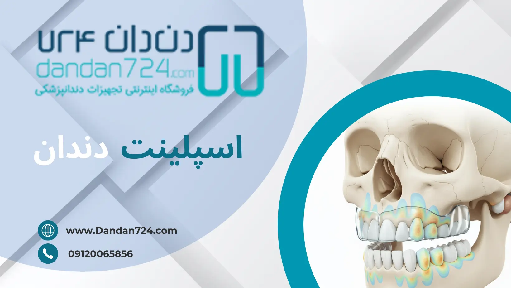 کارکرد اسپلینت - اسپلینت دندان