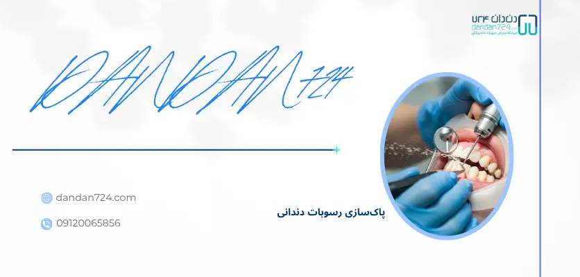 پاک‌ سازی موثر پلاک و جرم - پلاگر دندانپزشکی