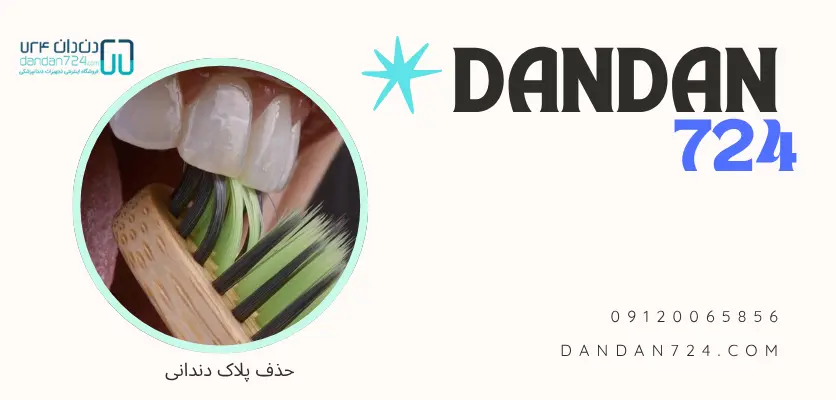 حذف کامل رسوبات دندانی - پلاگر دندانپزشکی