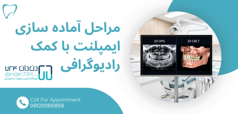 مراحل آماده سازی ایمپلنت - رادیوگرافی ایمپلنت دندان