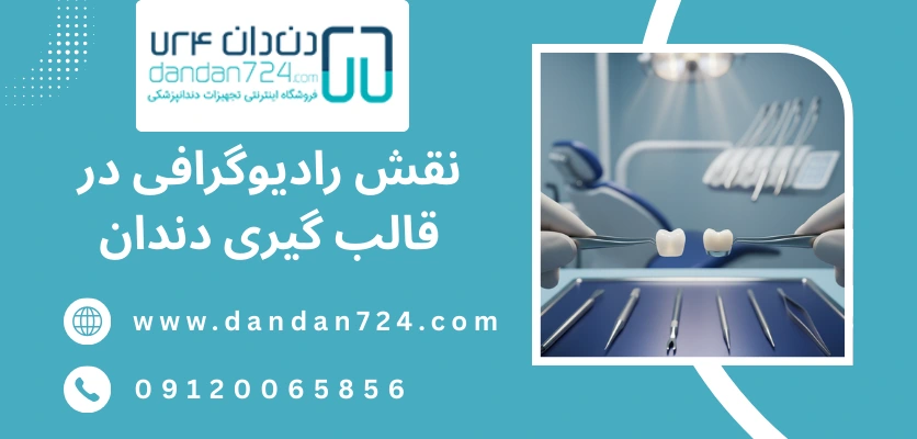 نقش رادیوگرافی در قالب دندان پزشکی - قالب گیری دندان 