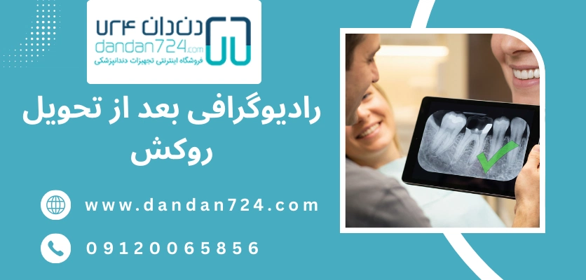 رادیوگرافی بعد از تحویل روکش - قالب گیری دندان 