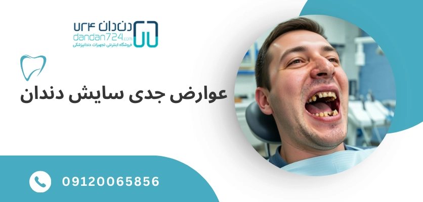 عوارض جدی ساییدگی دندان - ساییدگی دندان